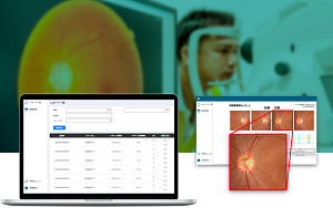 眼底画像の診断支援システム OPTiM Doctor Eye